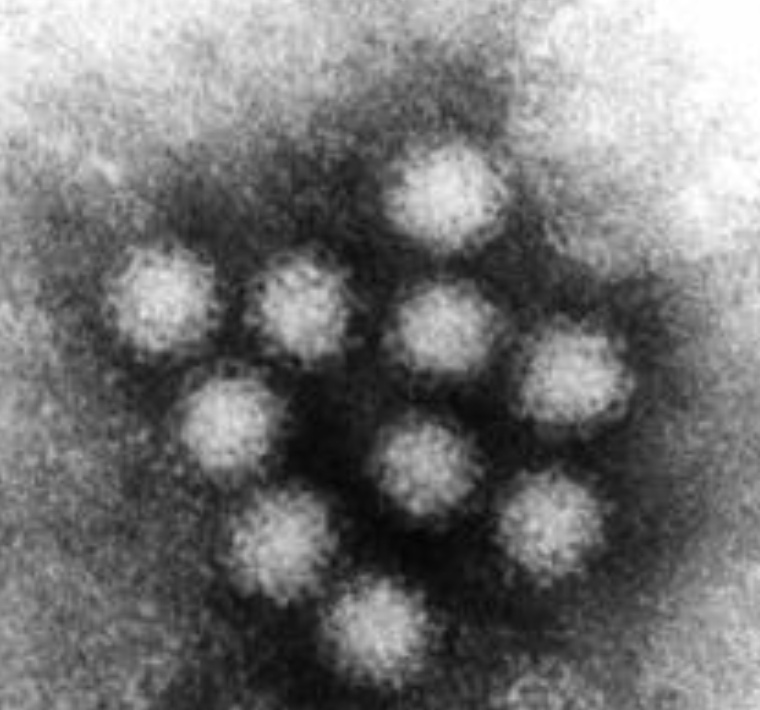 صورة مجهرية لnoravirus&nbsp;