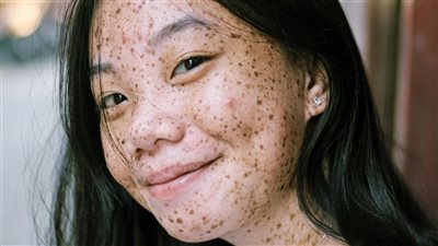 article